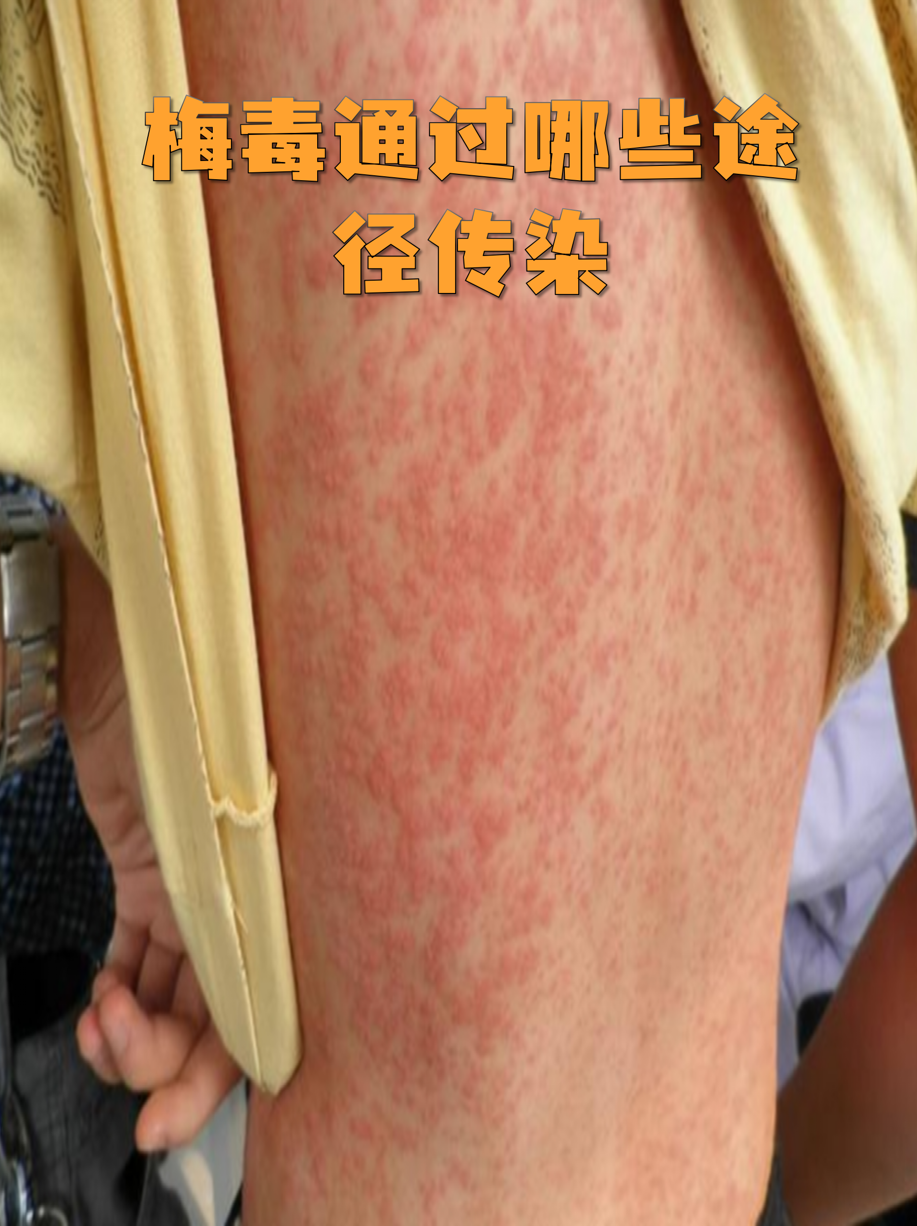 上海确诊夫妻感染病毒株型为德尔塔︰(上海夫妇感染病毒)-第2张图片