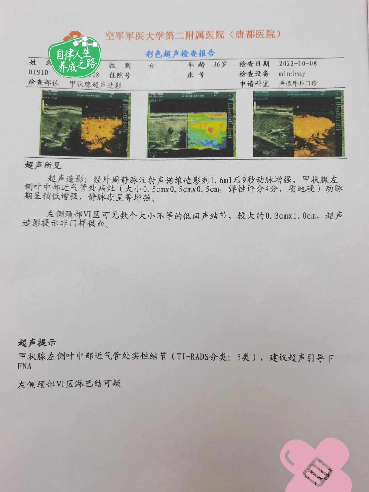 西安确诊病例怎么一下子增多了.西安的确诊病例-第1张图片