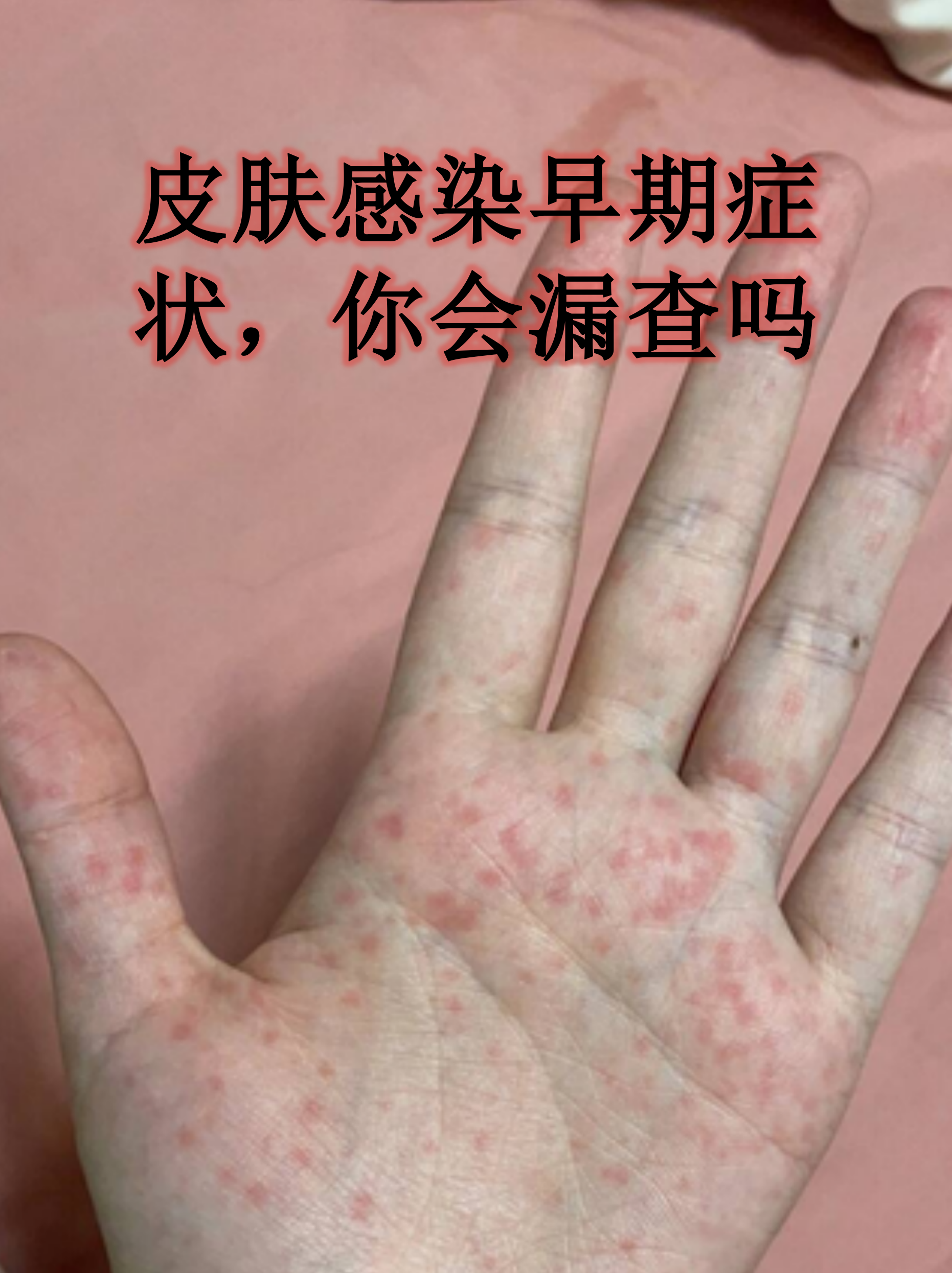 青岛无症状感染2人属早期感染者-青岛发现一例无症状感染者-第1张图片